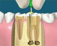 National Dental Hicksville image 1